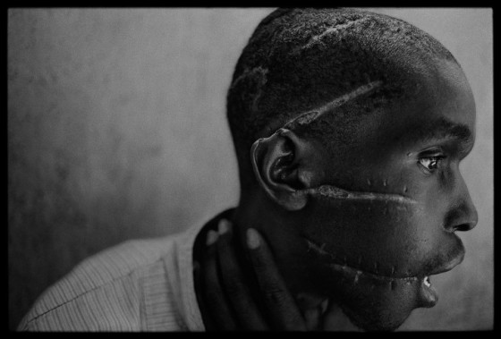A victim of the genocide © James Nachtwey